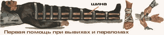 pervaya-pomoshh-pri-vyivihah-4