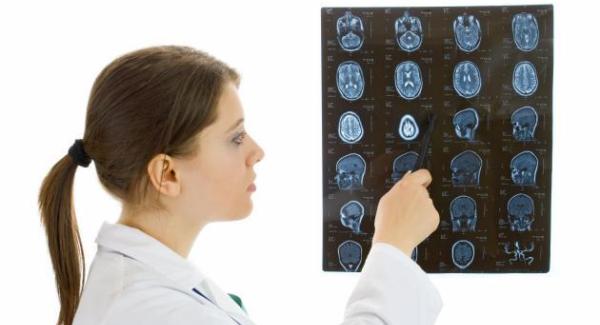 врач-смотрит-томограмму-черепа