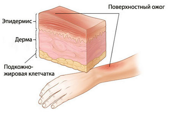 Повреждение кожного покрова